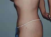 After Image