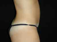 After Image