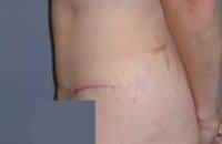 After Image