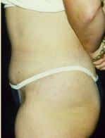 After Image