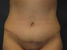 After Image