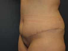 After Image
