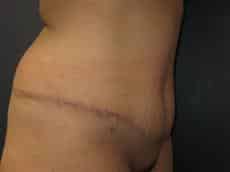 After Image