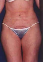 After Image