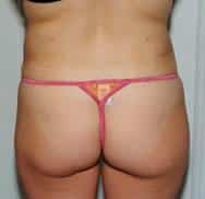 After Image