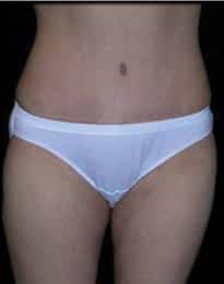 After Image