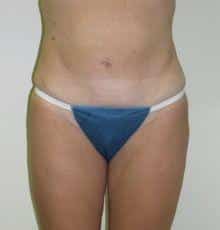 After Image