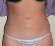 After Image