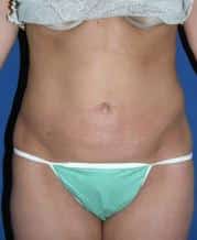 After Image