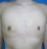 After Image