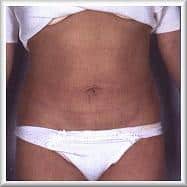 After Image
