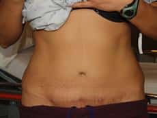 After Image