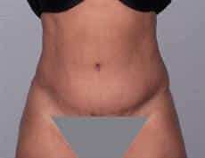 After Image