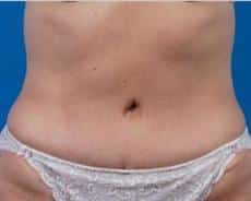 After Image