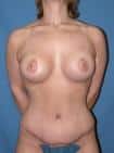 After Image