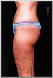 After Image