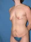 After Image
