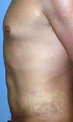 After Image