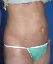 After Image