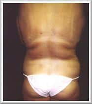 After Image