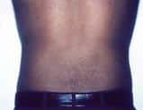 After Image