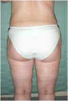 After Image