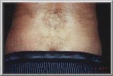 After Image