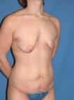 After Image