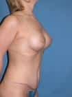 After Image