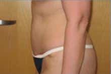 After Image