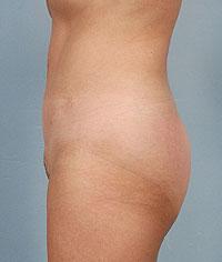 After Image