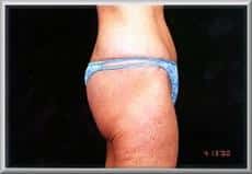 After Image