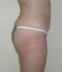 After Image