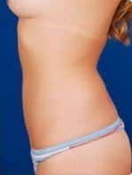 After Image
