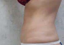 After Image