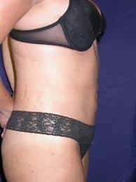 After Image
