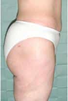 After Image