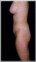 After Image