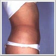 After Image
