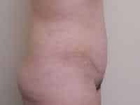 After Image