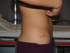After Image