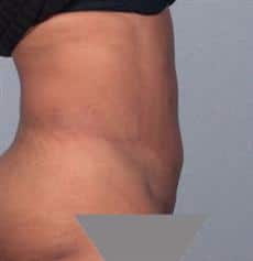 After Image