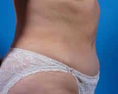 After Image