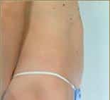 After Image
