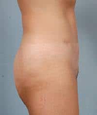After Image