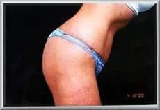 After Image