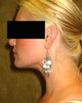 After Image