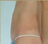 After Image