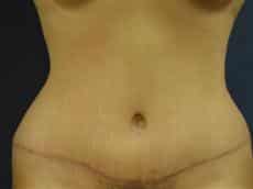 After Image