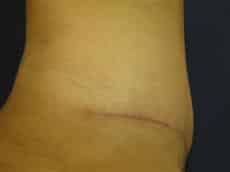 After Image
